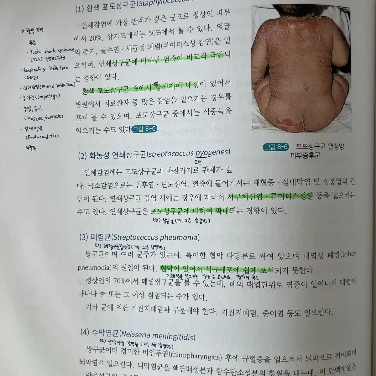 수문사 - 새로 쓴 병리학(20년도 출판)