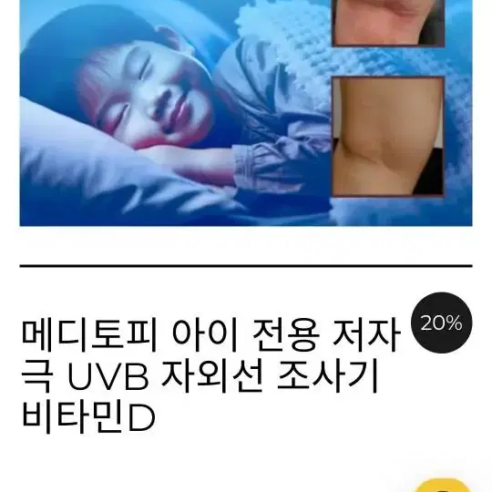 메디토피 uvb 조사기 비타민d 아토피 치료기