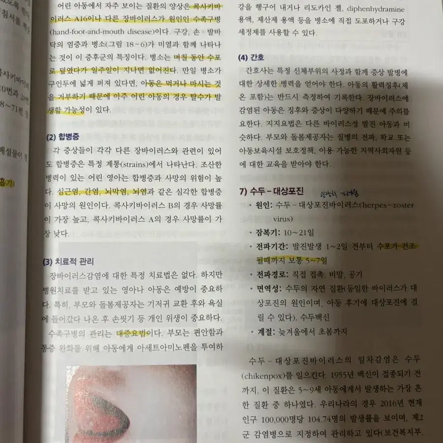 근거기반실무 중심의 아동간호학 하권 현문사