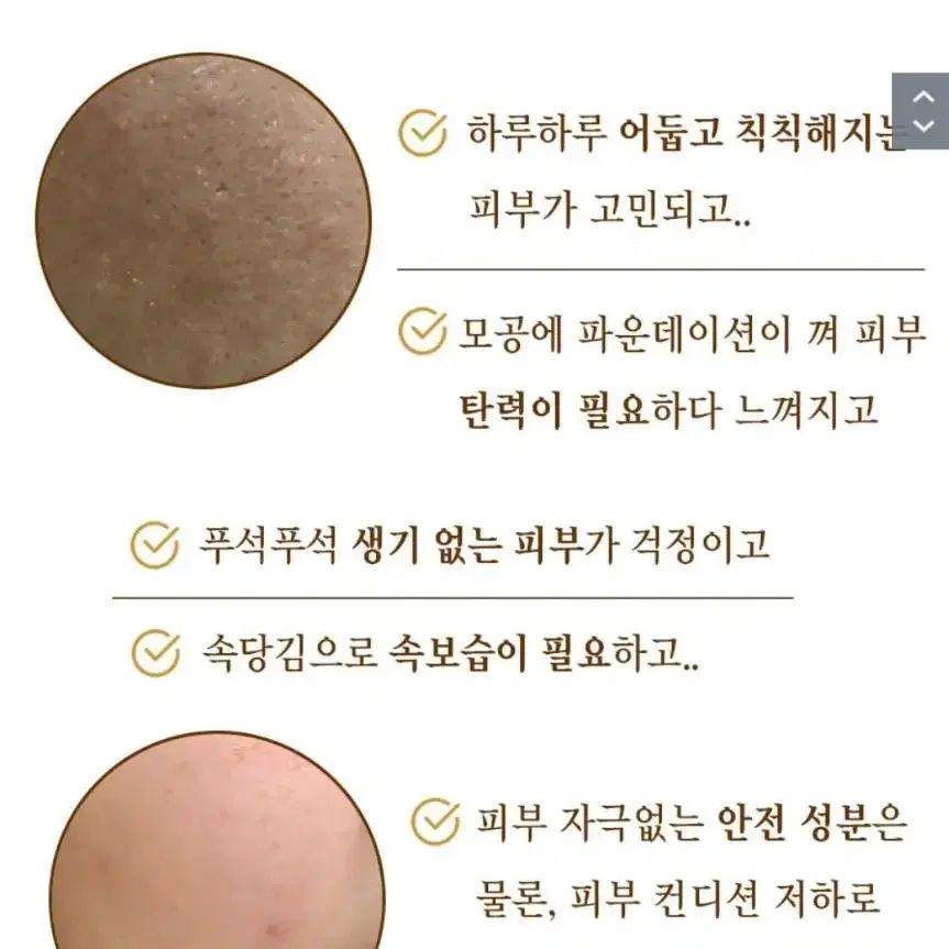 샤넬 리쥬란 피부과 시술 X 한번만 발라도 주름 모공 기미 탄력 앰플