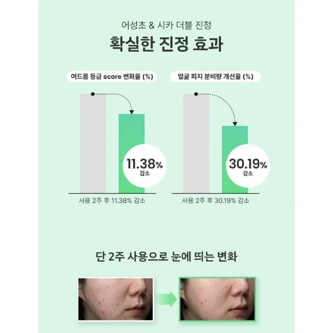 [미개봉]라엘뷰티 미라클 클리어 릴리프 수딩 토너 150ml