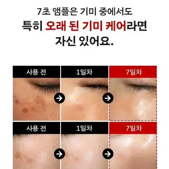 메디필 멜라논x 7초 앰플 기미 잡티 피부톤개선50ml