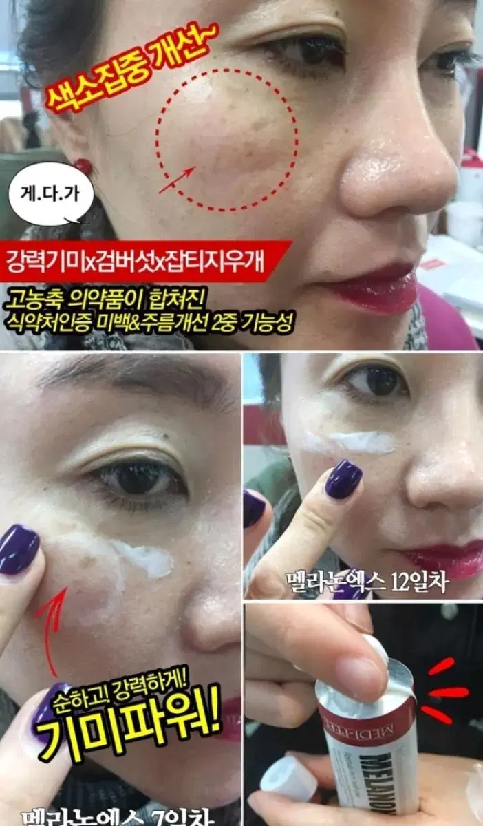 (신상)메디필 멜라논 엑스 프로 크림 기미 잡티 색소침착 다크서클 화장품