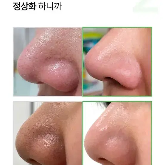 모공콩라겐앰플