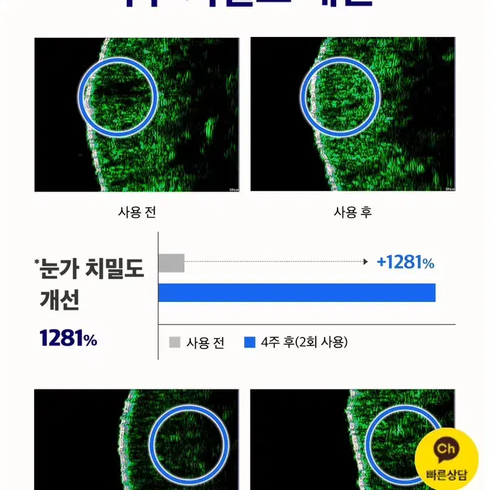 [DUAL SONIC] 듀얼소닉 프로페셔널 본체