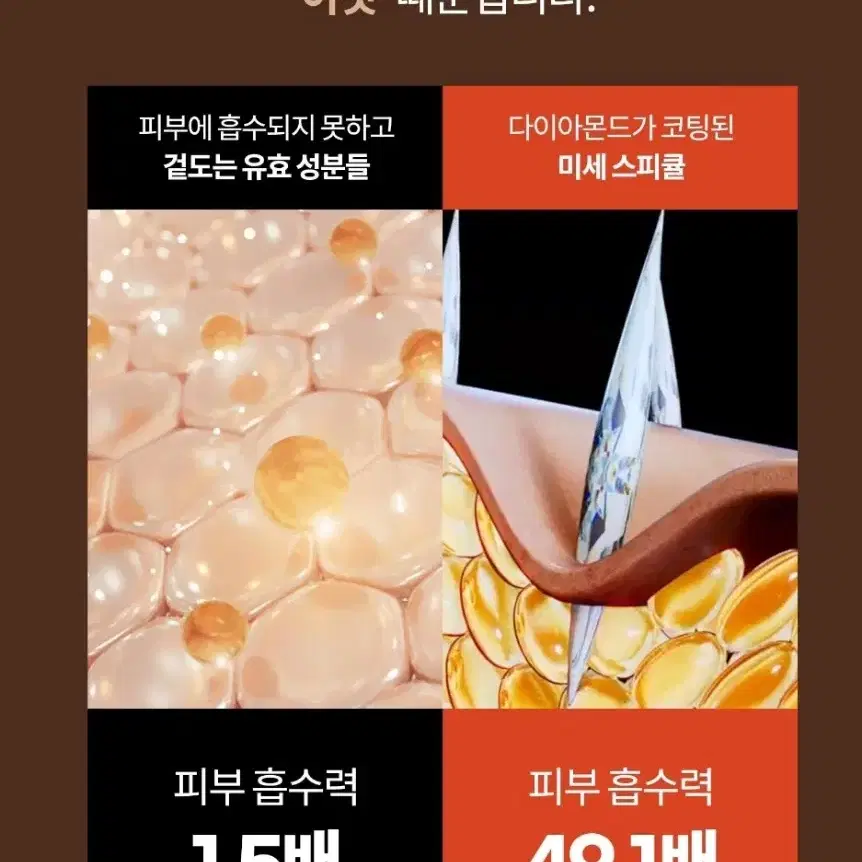 다이아 스피테라앰플