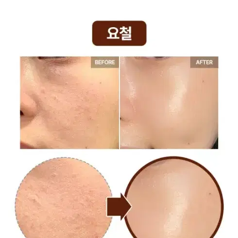 레티놀보다 11배 강력한 레티날) 시모먼트 퓨어 레티날 콜라겐 크림 20