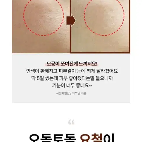 레티놀보다 11배 강력한 레티날) 시모먼트 퓨어 레티날 콜라겐 크림 20