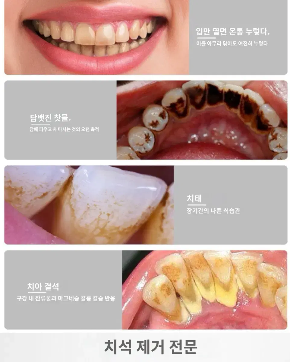 새-초음파 전동치석세척기 치석제거기x2미백전동칫솔x3