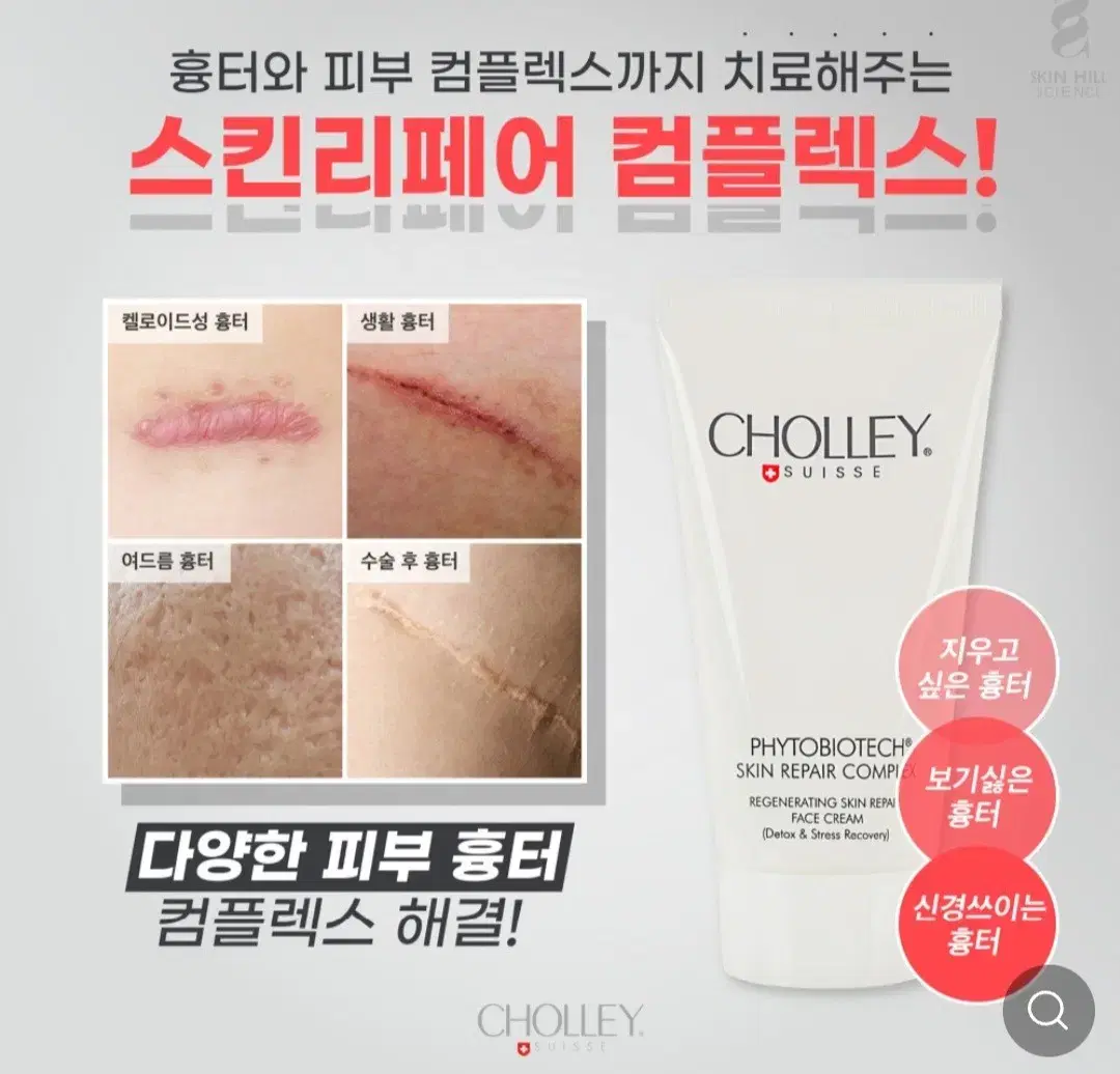 숄리 파이토바이오텍 리페어 컴플렉스 흉터재생크림 150ml