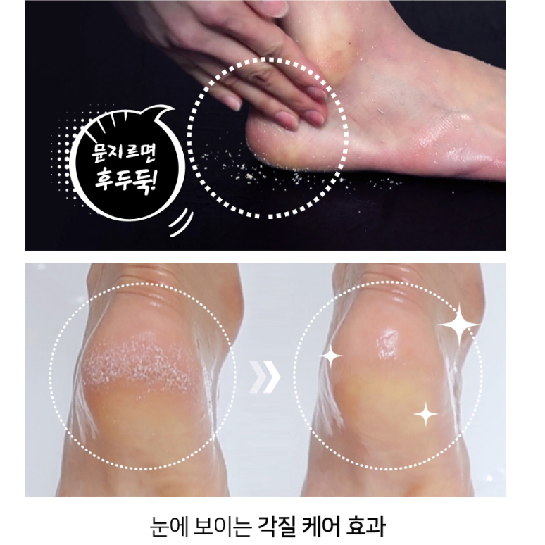 무료배송-온더바디 발각질 벗자 풋필링스프레이 240ml 3개