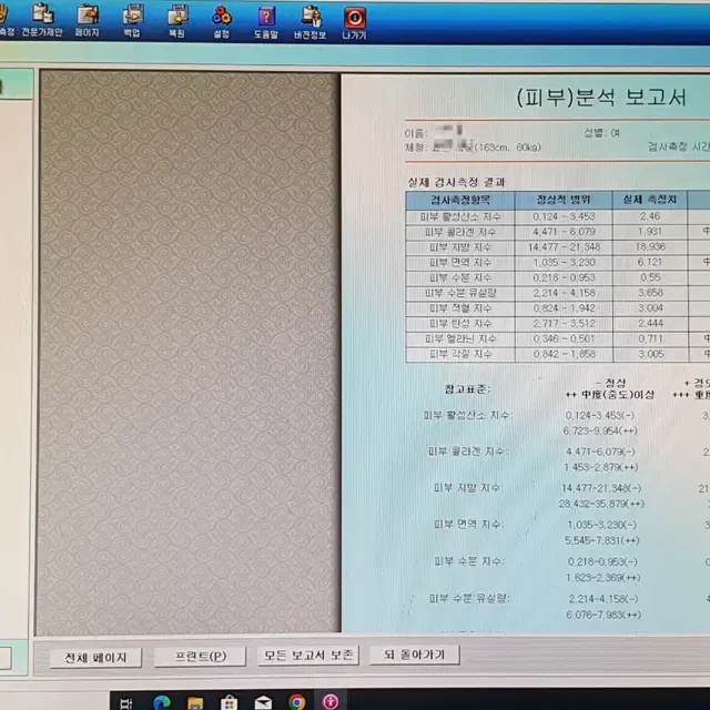 퀀텀 바이오 스캐너 양자공명기