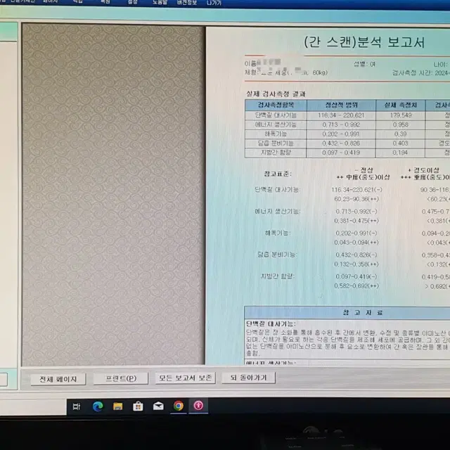 퀀텀 바이오 스캐너 양자공명기