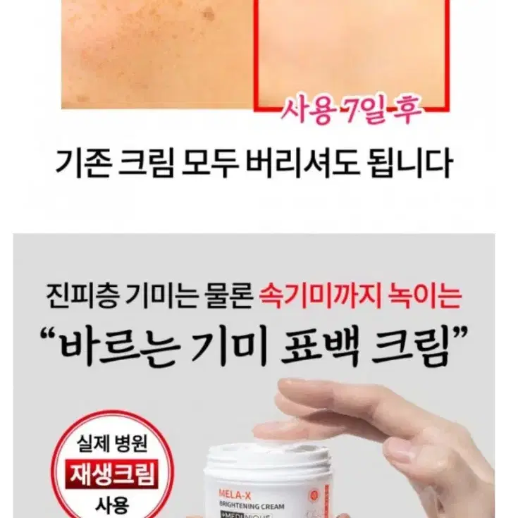 기미크림 묵은기미표백 전문가용 기미전문크림 색소침착감소 피부재생 잡티제거