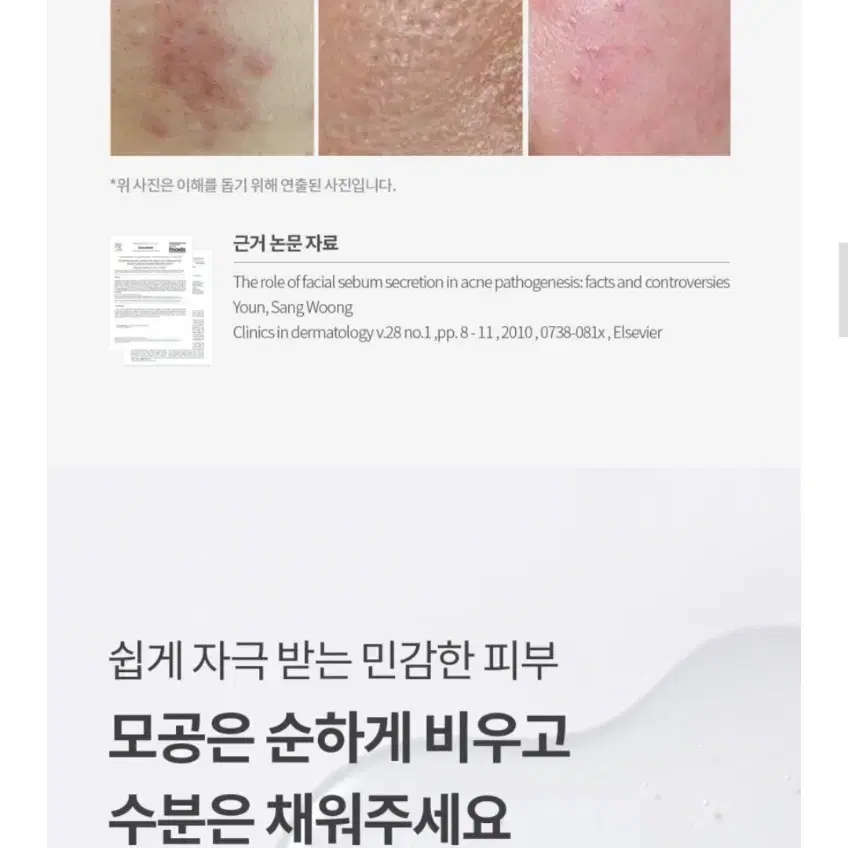 미개봉)허브노트 어성초 진정 앰플 교신가능