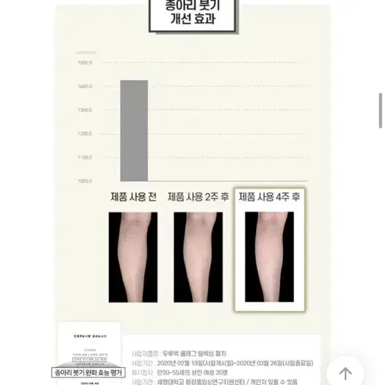 우루렉 종아리 부기 붓기 김호중 에이블리 교신