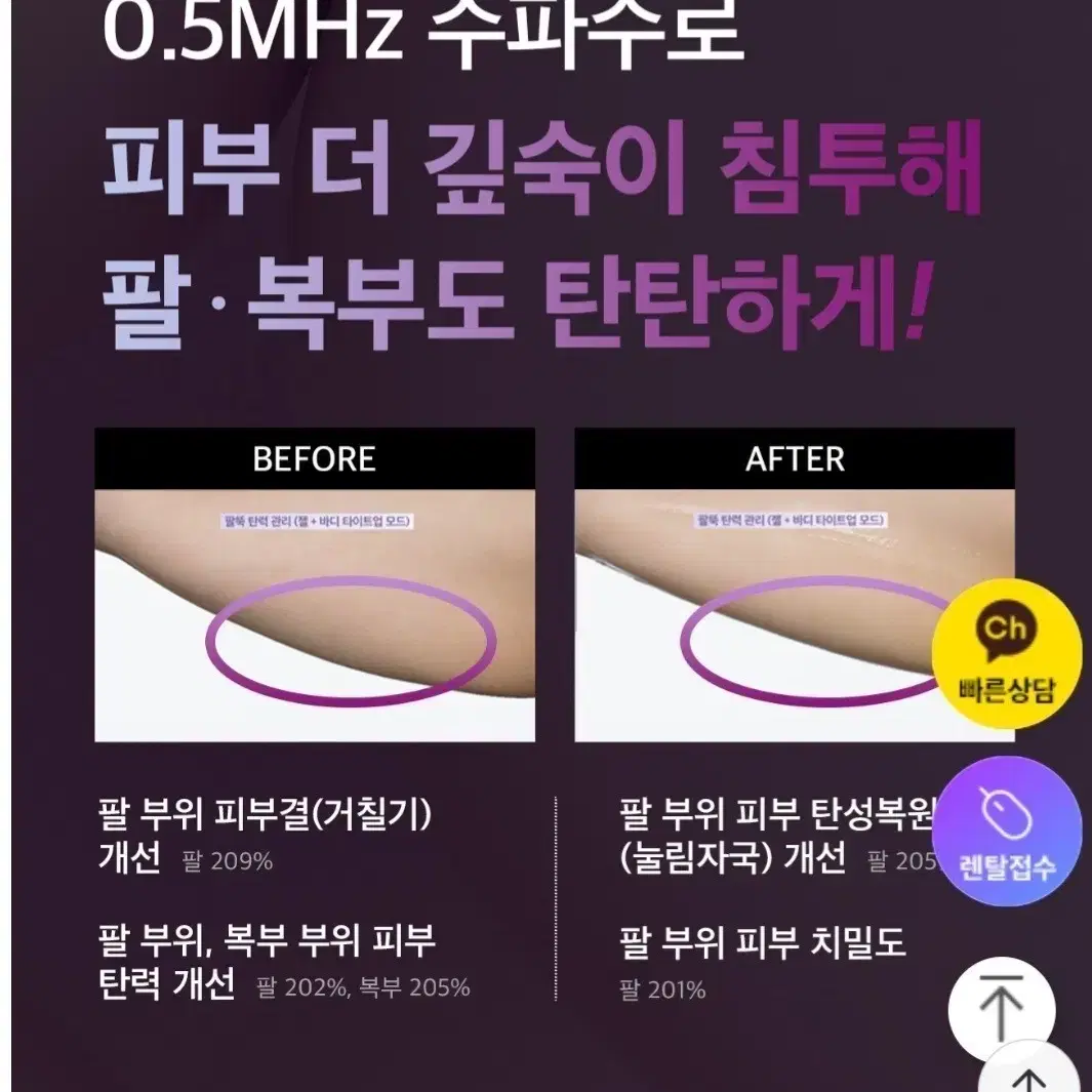 듀얼소닉알토고주파관리기