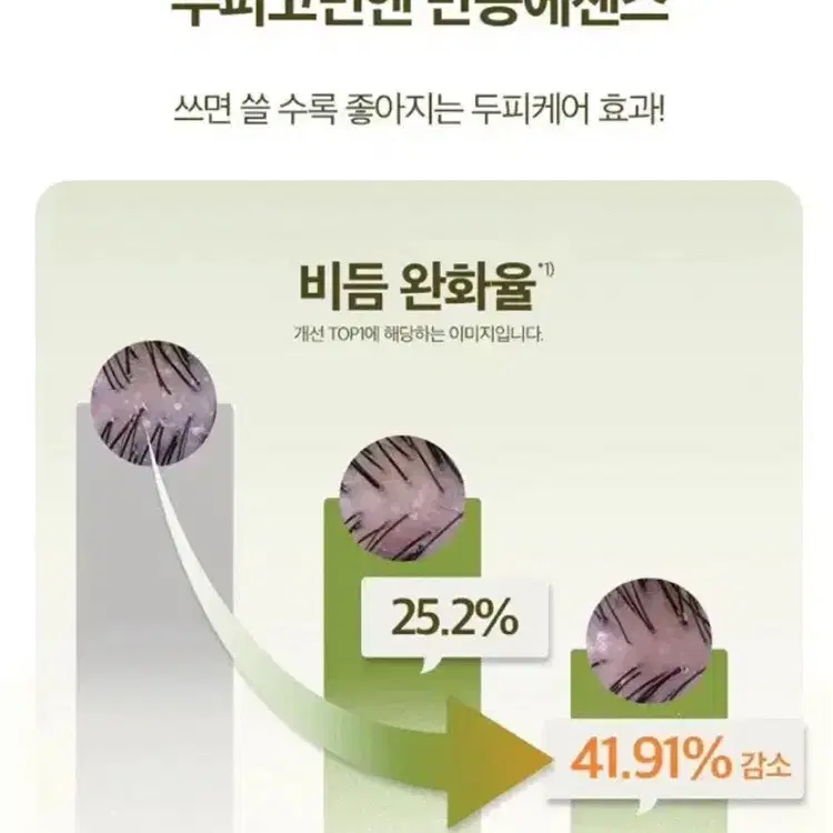 고윤정 려 루트젠 탈모 두피케어 에센스 올리브영에이블리ts미샤아리따움