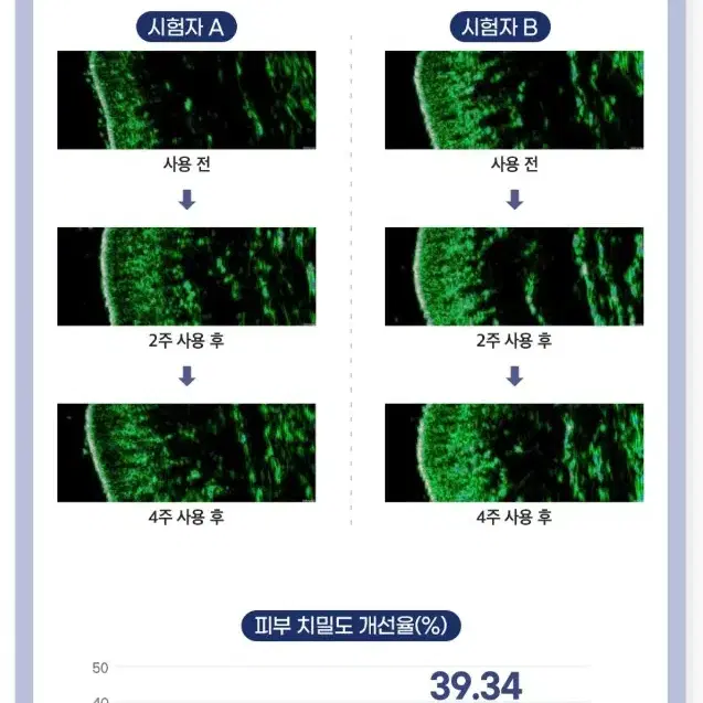 라비앙 메디닉라인 4000샷 마이크로샷 스킨 롤러 mts 녹는 리들