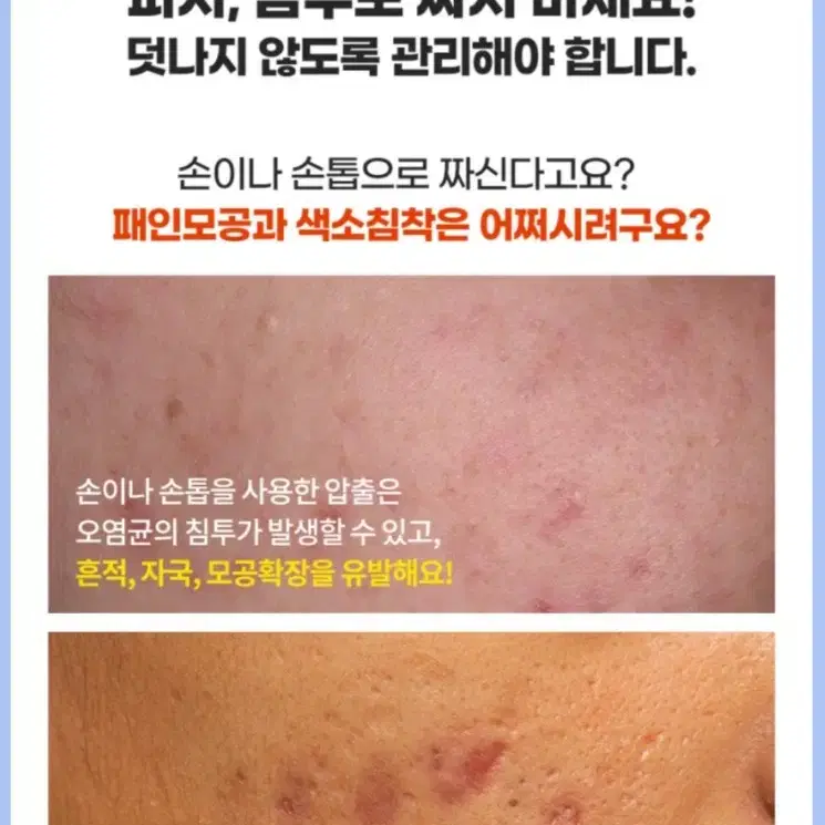 닥터웰메이드원 좁쌀피지 순삭패치 마일드(44매)