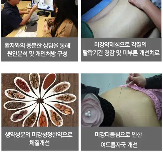 한의원 몸 여드름 흉터 시술권 양도