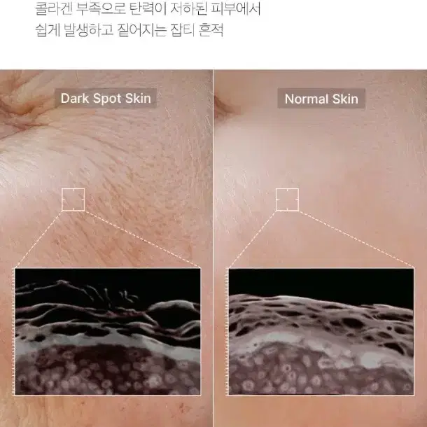 택포) 메디큐브 피디알엔 핑크 펩타이드 앰플 연어 미백 주름개선 2중