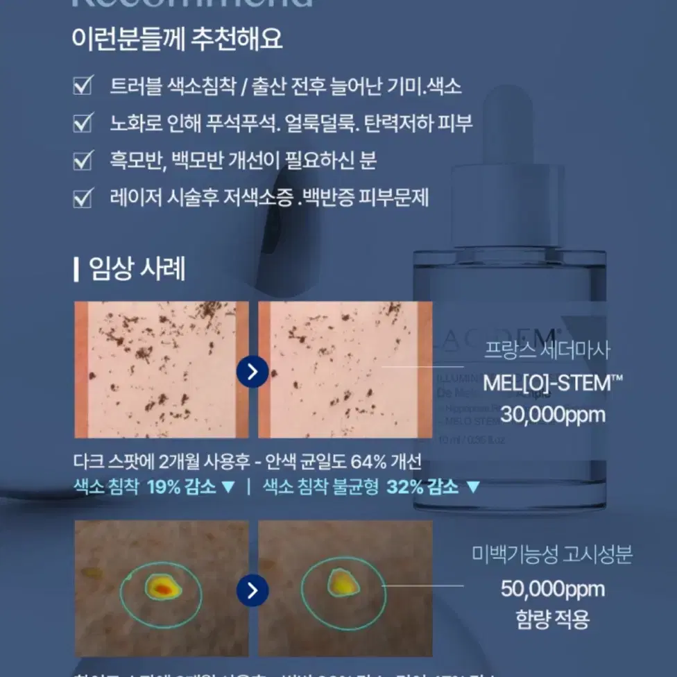 라시뎀 미백 앰플 10ml (디멜라 화이트 앰플) 미개봉 새제품