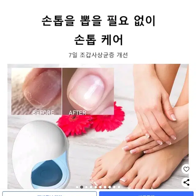 무좀치료, 진균레이저입니다