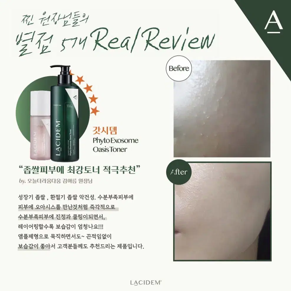 라시뎀 엑소좀 토너 150ml 스킨 에스테틱 피부관리실 화장품 건성