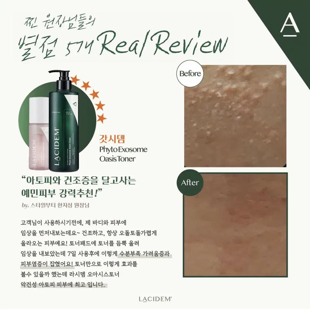 라시뎀 엑소좀 토너 150ml 스킨 에스테틱 피부관리실 화장품 건성