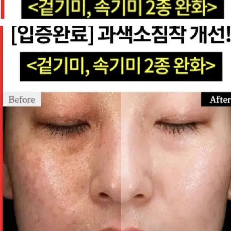 묵은기미표백 크림