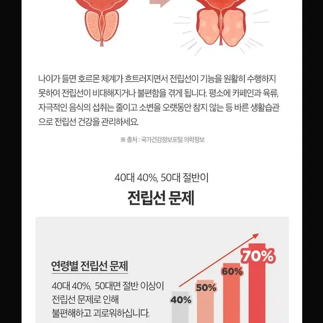 (1+1)10중 기능성 초임계 쏘팔메토 옥타코사놀 맥스