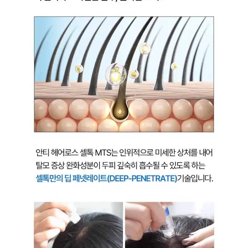 헤솔 셀톡 MTS 탈모 영양제 판매합니다.