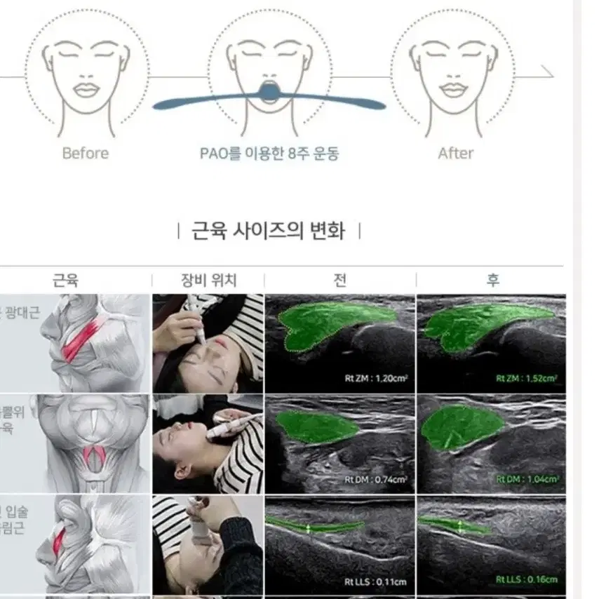 얼굴마사지 작은얼굴만들기(팔자주름)