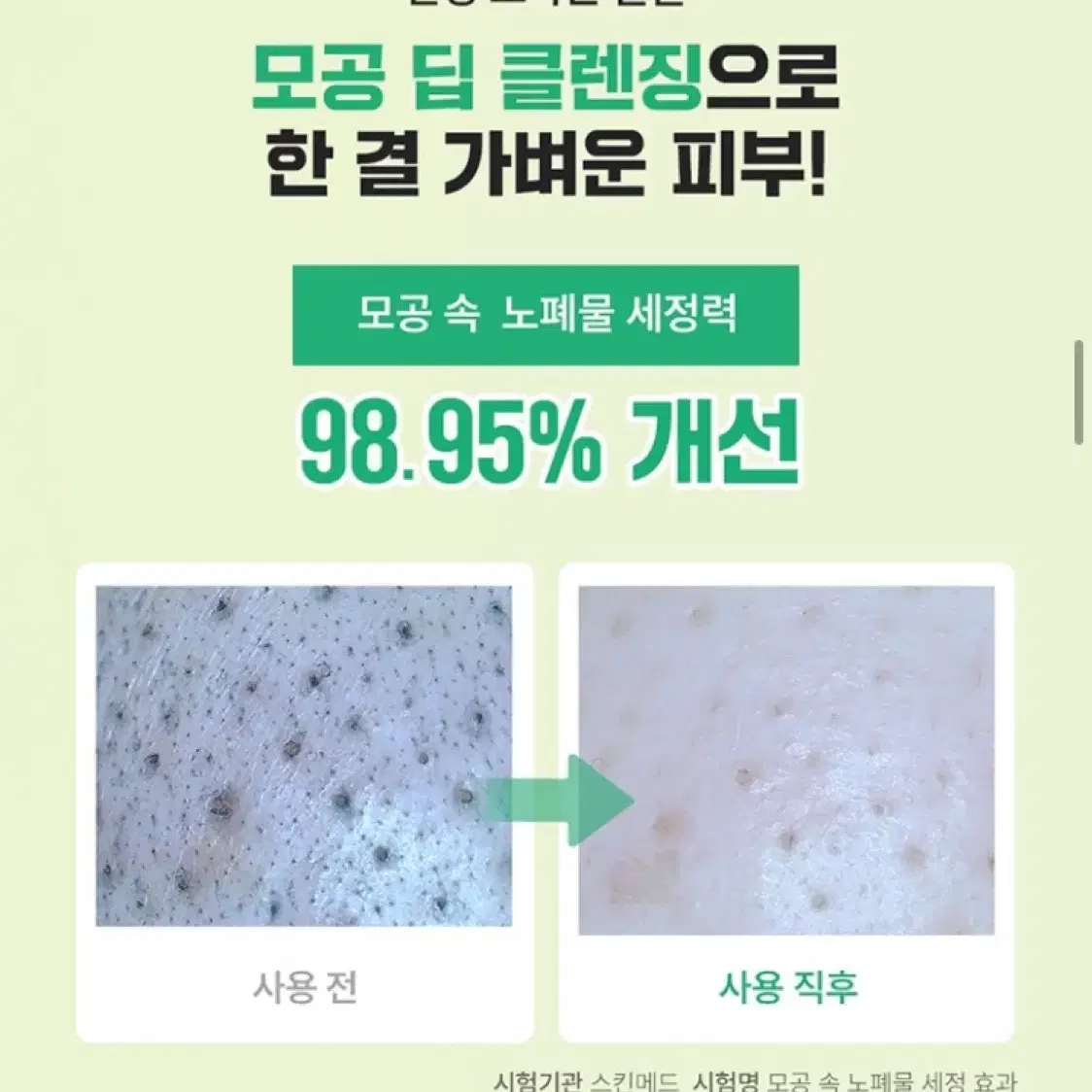 수이스킨 어린 새싹 딥 클렌징폼 150ml 교신