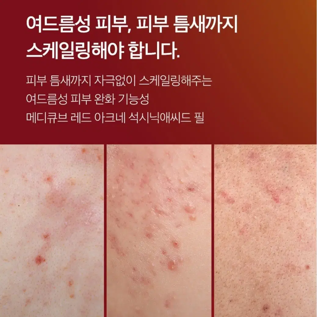 메디큐브 레드 아크네 석시닉애씨드 필 트러블 여드름 관리 필링