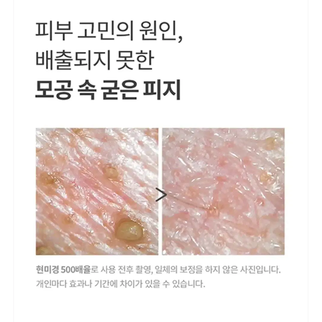 허브노트 어성초 약산성 마일드 딥 폼 클렌저