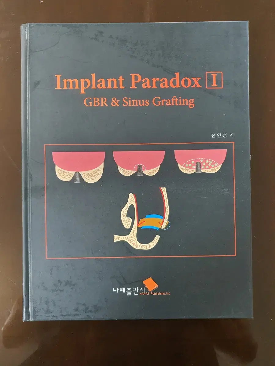 치과 임플란트 책 서적 implant paradox 부재 GBR&Graf