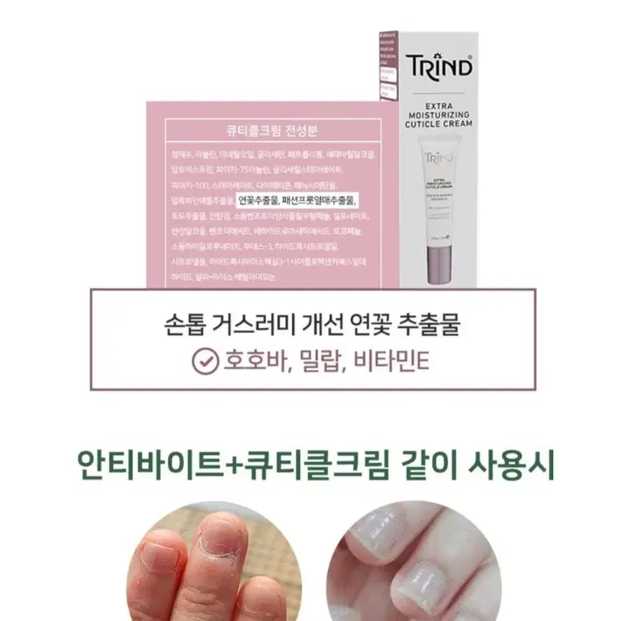 안티바이트9ml + 큐티클크림15ml 물어뜯는습관 문제성 손톱 거스러미