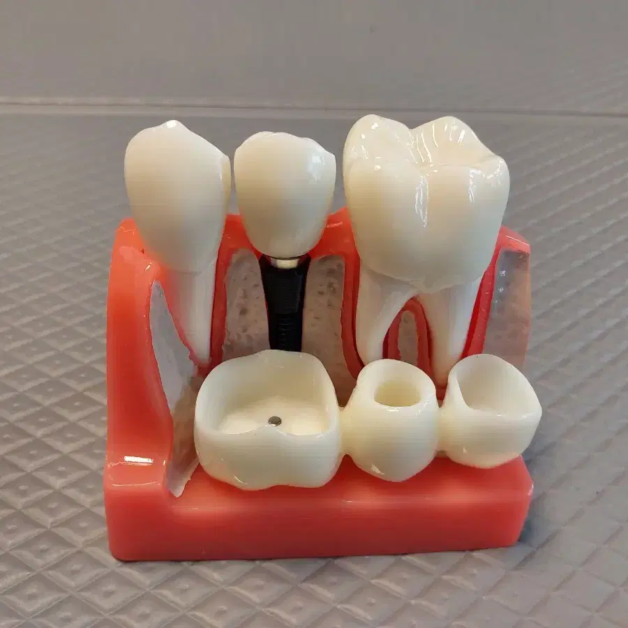 고급형 치아 모형 새제품 두가지 팝니다