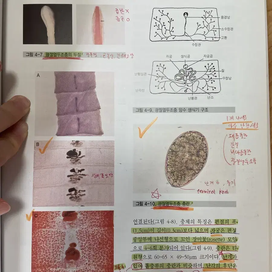 인체기생충학