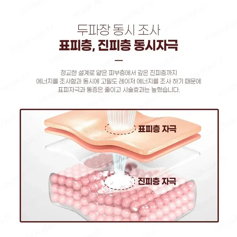 포텐 프락셔널 렌즈 레이저 전용 렌즈 레이져 렌즈 피부관리 렌즈