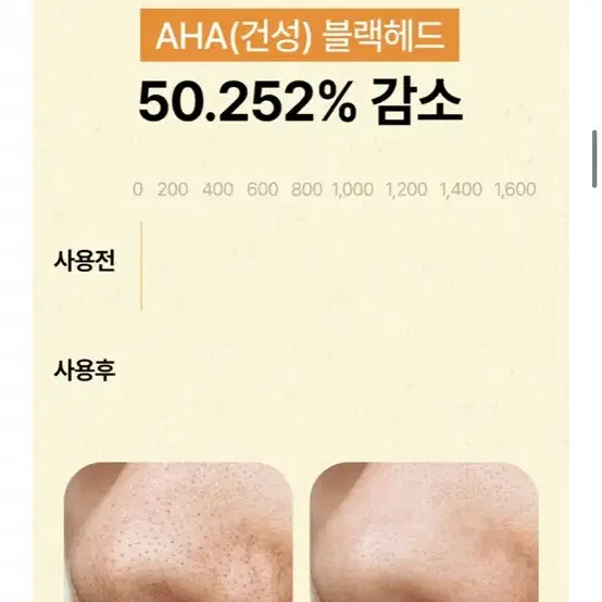 250만개 팔린 1위 클렌징오일 한스킨 블랙헤드제거 PHA 300ml