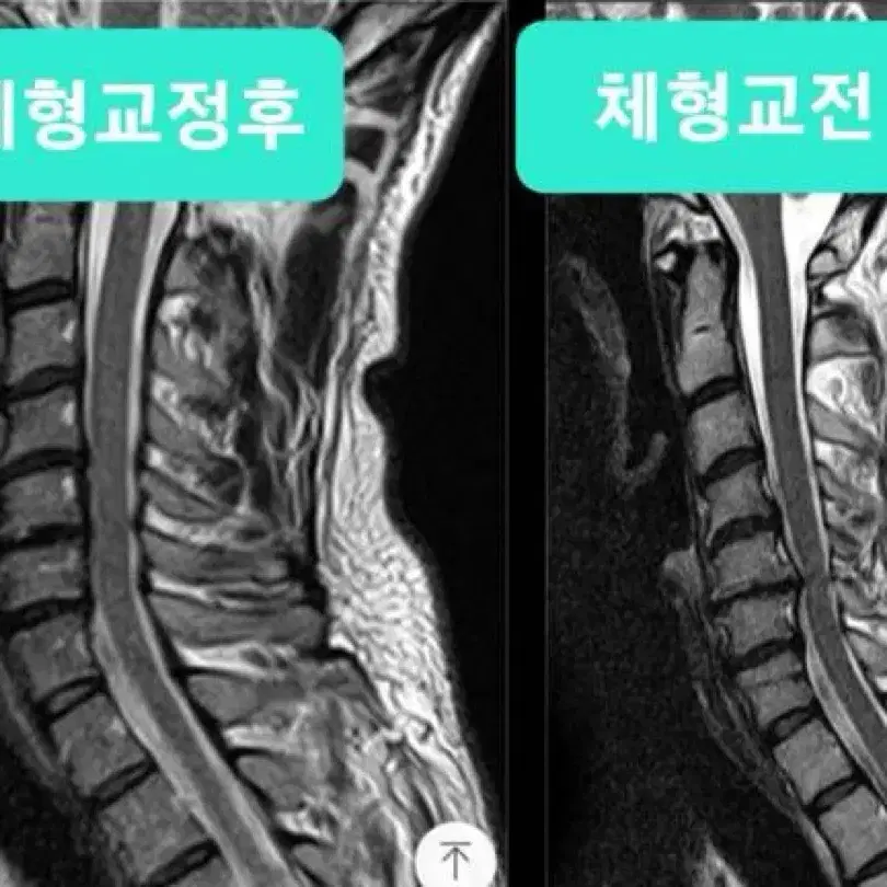 [[진골 체형교정]]