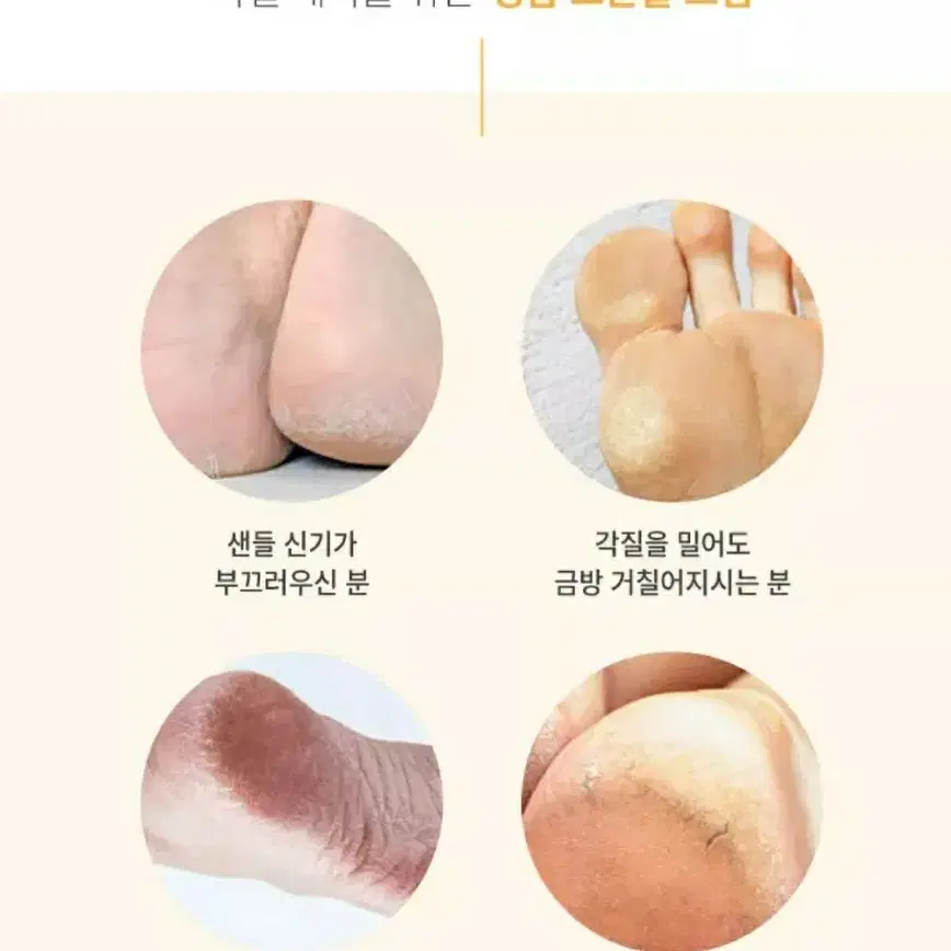 웰빙헬스 고운발 풋크림 풋케어 발크림