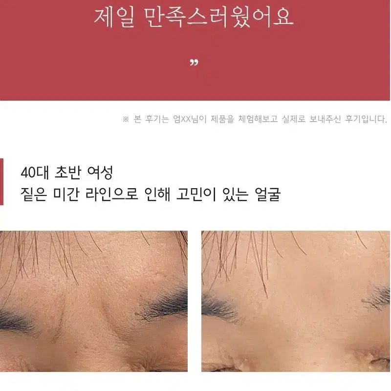 미간 주름 패치 아르페 일레븐라인 4패치 팝니다.