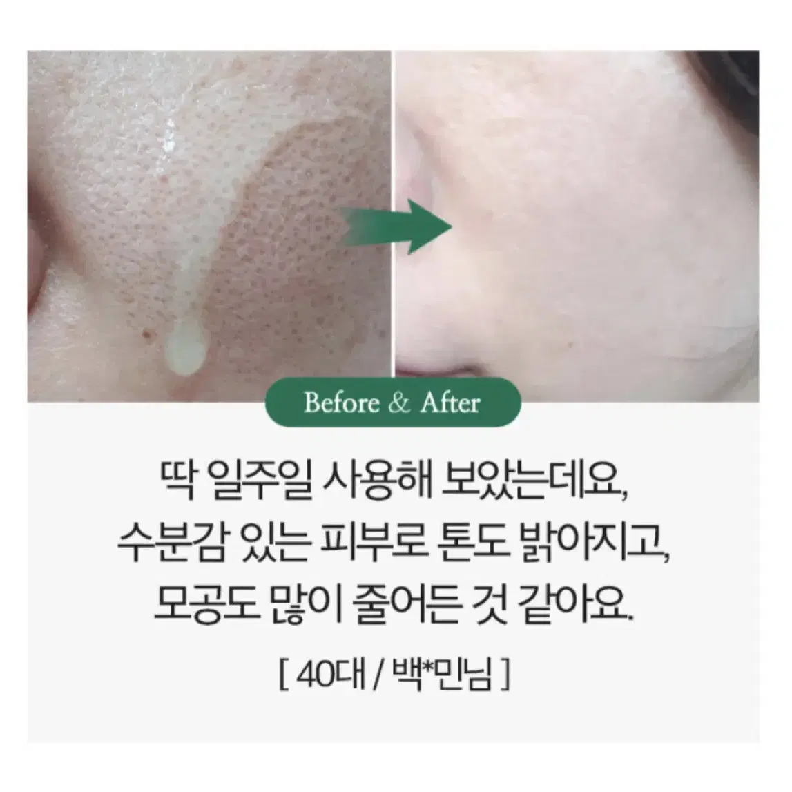 바다포도 모공수축 리프팅 앰플 50ml 판매합니다.[새상품]