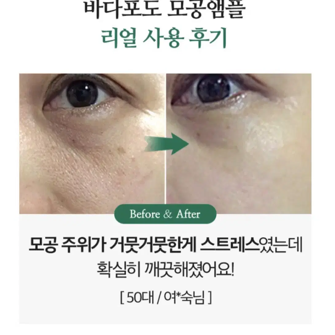 바다포도 모공수축 리프팅 앰플 50ml 판매합니다.[새상품]