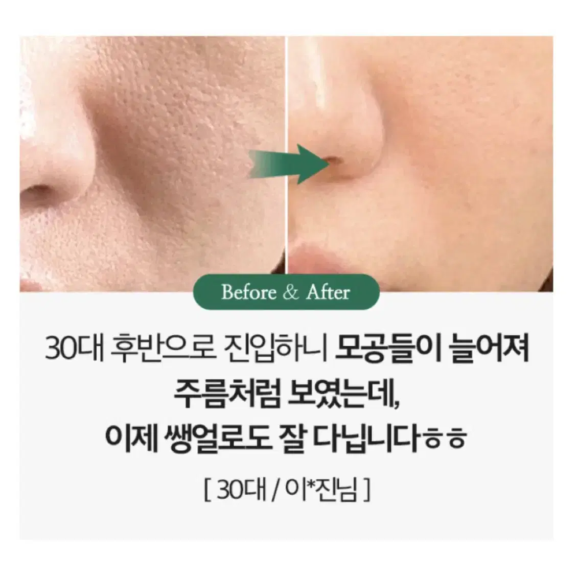 바다포도 모공수축 리프팅 앰플 50ml 판매합니다.[새상품]