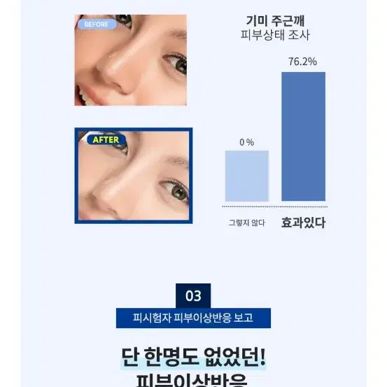 셀비뉴 기미이레이져